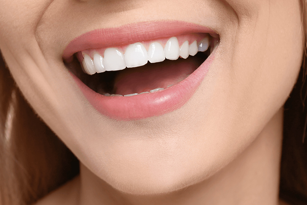 ابتسامة هوليوود في تركيا